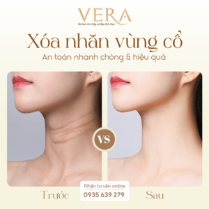 Tái sinh làn da cổ, lấy lại vẻ thanh xuân rạng rỡ tại Vera Spa