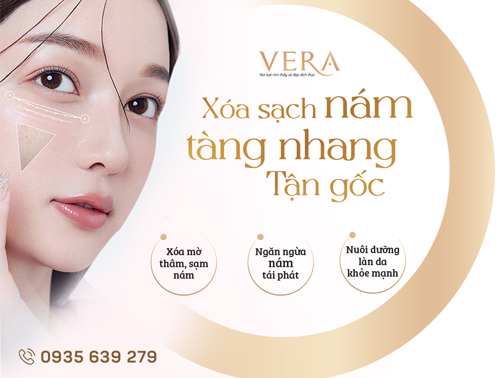 điều trị nám tận gốc tại Vera spa